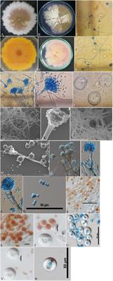 First report on the metabolic characterization of Sterigmatocystin production by select Aspergillus species from the Nidulantes section in Foeniculum vulgare